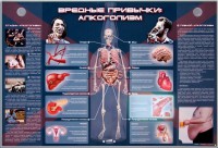 Электрифицированный стенд "Вредные привычки: алкоголизм" - fgospostavki.ru - Ярославль