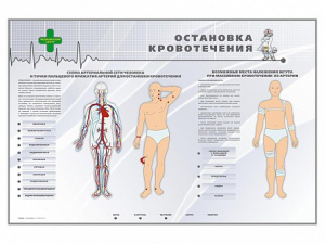 Электрифицированный стенд "Остановка кровотечения" - fgospostavki.ru - Ярославль
